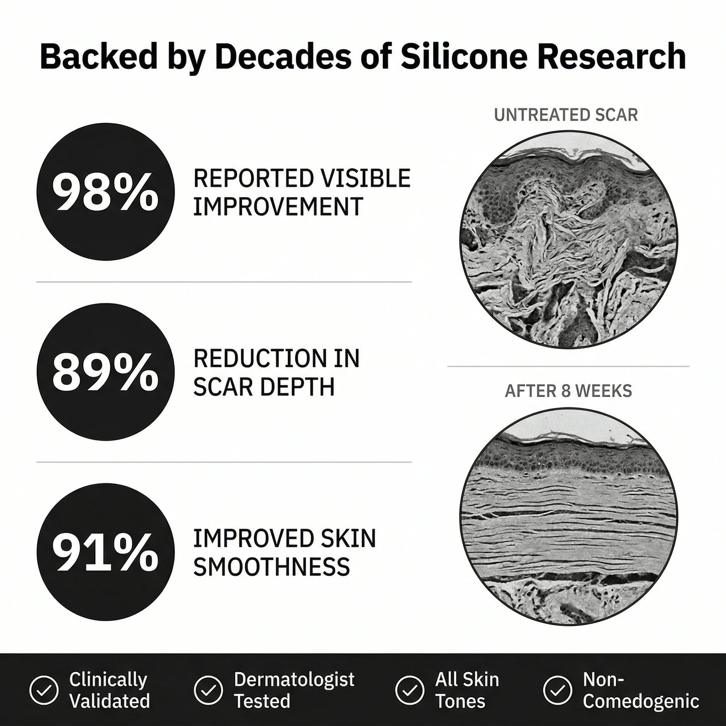 Silicone Scar Stick: Finally, A Fix That Actually Works On Acne Scars.